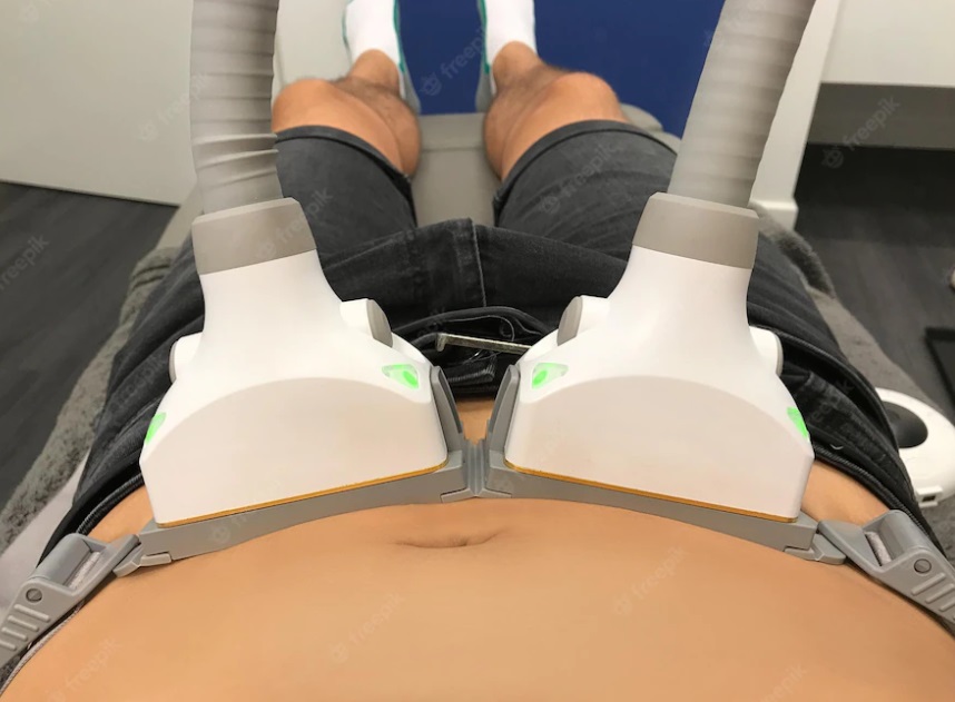 لیزر لیپولیز