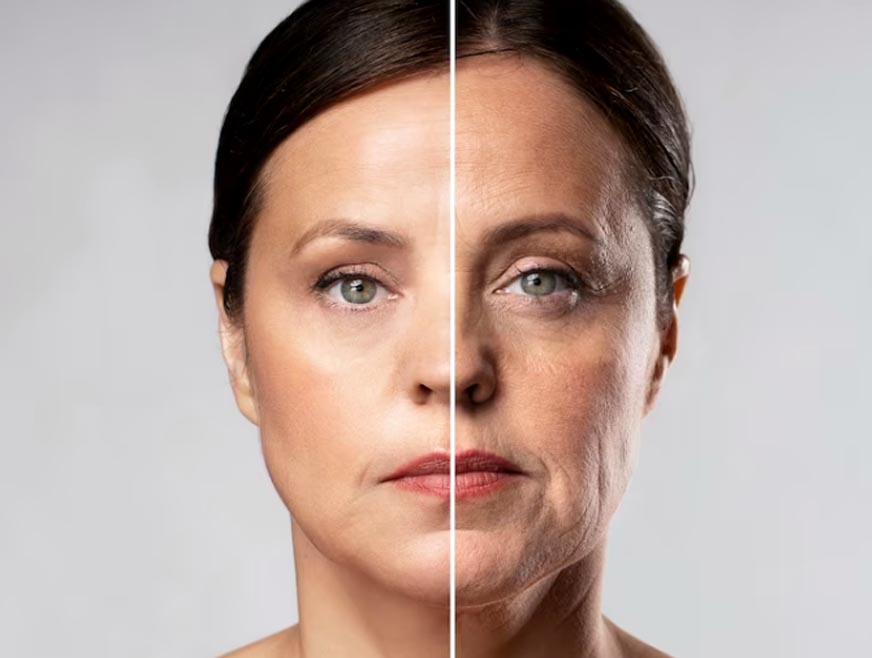 دستگاه اندولیفت: کاربردها، مزایا و عملکرد