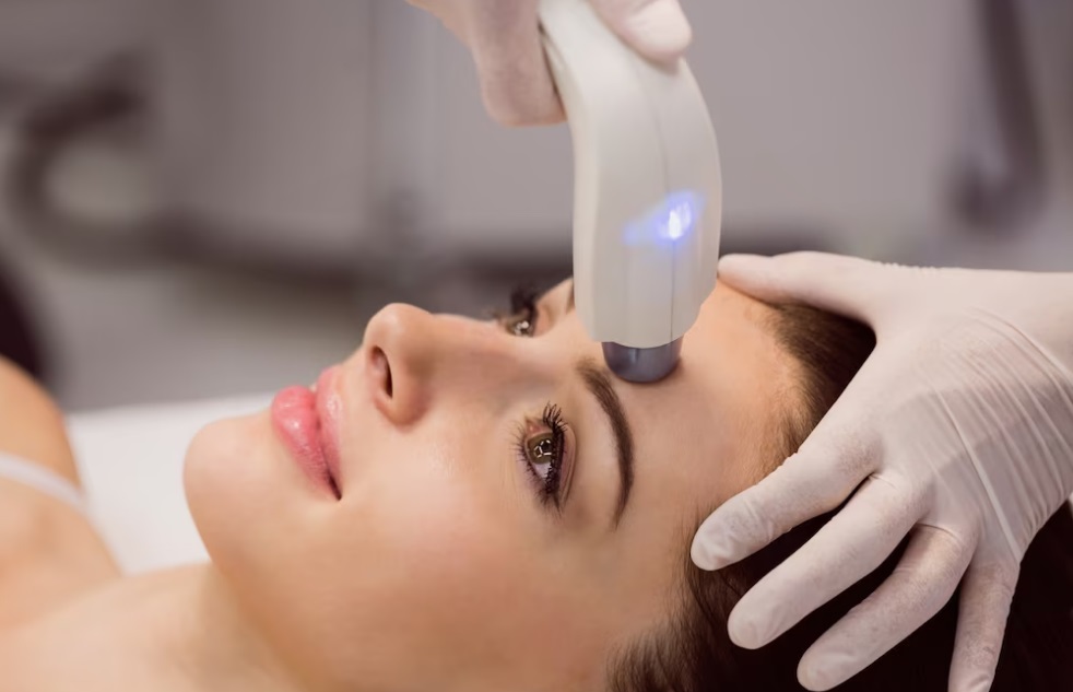 اندولیفت یا لیزر: کدام یک برای بهبود پوست مناسب‌تر است؟